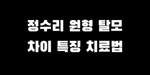 정수리 원형 탈모 차이점 특징 구분 방법 치료 비용